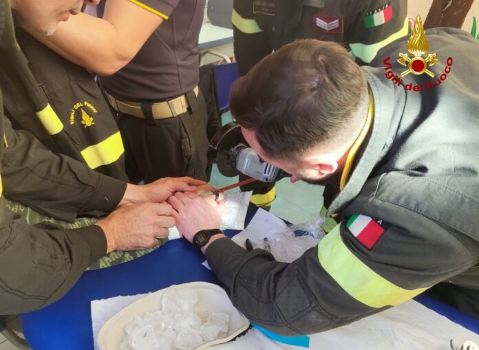 Vigili del fuoco tagliano anello incastrato nel dito di un adolescente